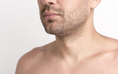 Trasplante de pelo corporal: cómo funciona y en qué casos es efectivo