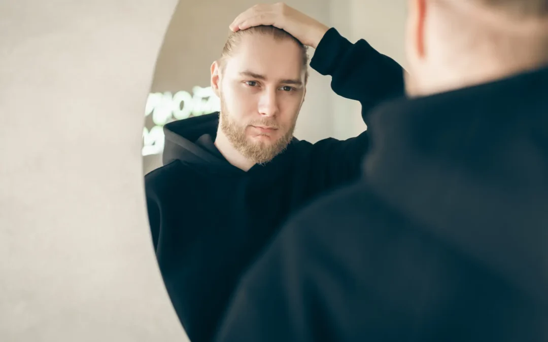Entradas en el cabello: Estrategias, Causas y Soluciones