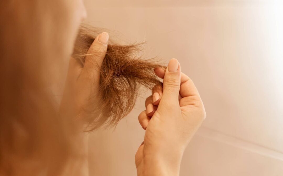 Se me cae el cabello a puños: ¿Qué puede estar pasando?