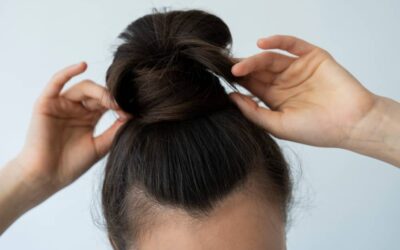 Alopecia por tracción: qué es, por qué ocurre y cómo tratarla
