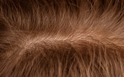 ¿Qué es el cuero cabelludo: qué tipos y cuidados existen?