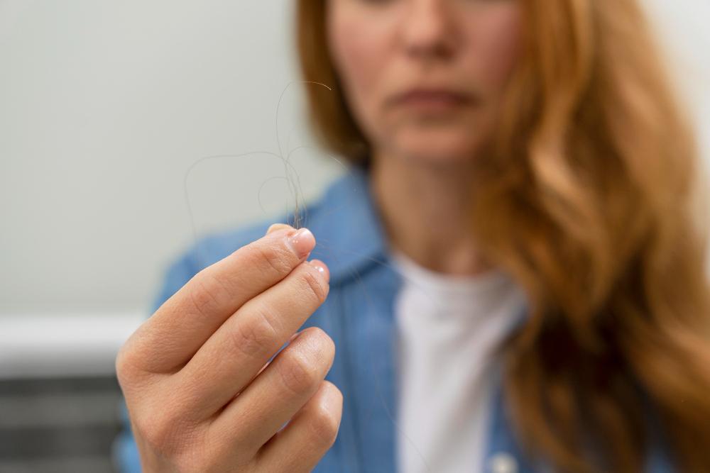 mujer con pérdida de cabello